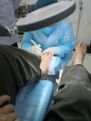 -派恩宜灰指甲鸡眼嵌甲手足癣