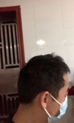 -大麦微针植发全国连锁