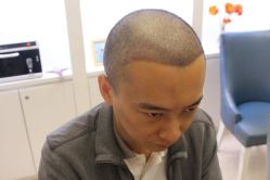 点击看大图 -大麦微针植发丨全国连锁