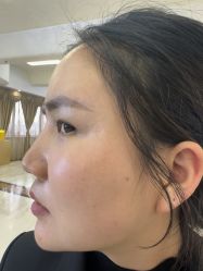 -长沙雅美医疗美容医院