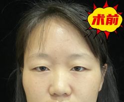 -素美医疗美容·西南眼鼻整形·修复基地