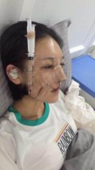 -洁铭新加坡医美