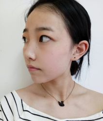 点击看大图 体验前-鑫元辰医疗美容整形