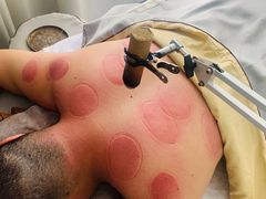 -沁欣堂推拿艾灸