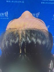 -雍禾植发全国连锁