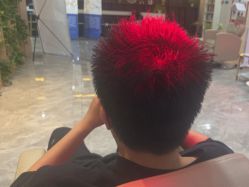 -碧莲盛·不剃发植发