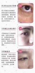-美人痣全国连锁