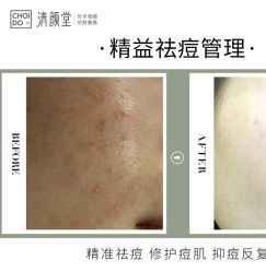 -清颜堂丨分子祛痘·功效美肤
