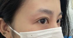 体验后-杭州奥拉克医疗美容门诊部