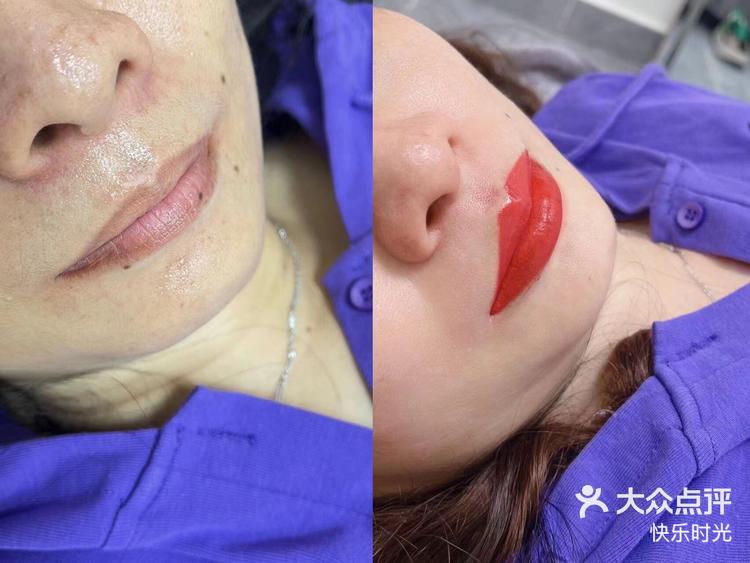 绣唇膏的简单介绍