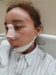 点击看大图 体验后-鑫元辰医疗美容整形