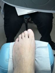 -派恩宜灰指甲鸡眼嵌甲手足癣