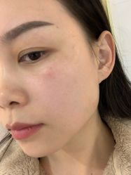 -广东韩妃整形外科医院