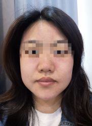 -More摩尔医美の注射线雕光电中心