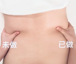 -Fundi张玉珊修身堂·indiba·BTL科技瘦身