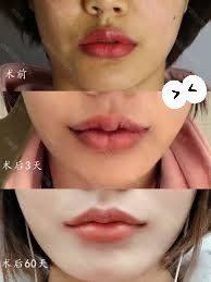 -SKINIST丽铂医疗美容