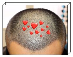 -大麦微针植发全国连锁