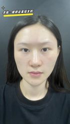 -素美医疗美容·西南眼鼻整形·修复基地
