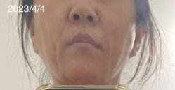 -广州美莱医疗美容医院