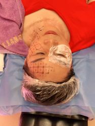 体验前-深圳美莱医疗美容医院