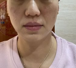 -澳尔颜选医疗美容