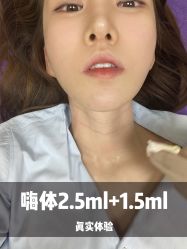 -大华韩艺整形美容医院