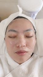 -珍贞佰俪·针清祛痘印敏感管理