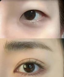 点击看大图 -郡艺医疗美容·微整·眼鼻吸脂