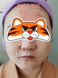 点击看大图 体验前-东莞台心医院-医疗美容