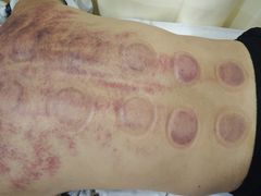 -手功夫·月明中医诊所·正骨推拿艾灸
