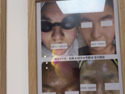 -美肤盾祛痘·问题肌头疗管理中心