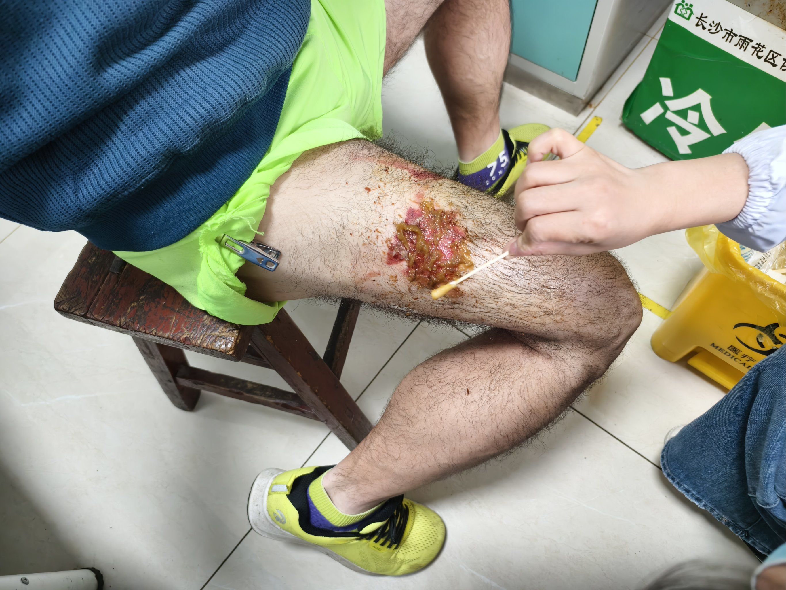 为什么要给树打针呢为什么在线