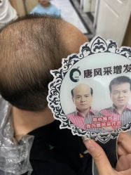 -唐风采假发补发定制