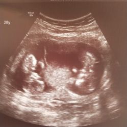 -中国福利会国际和平妇幼保健院(徐汇院区)