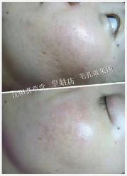 -荟草堂痘肌修护中心