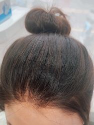 -雍禾植发全国连锁