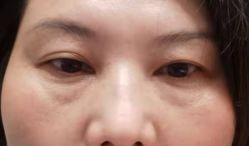 体验前-华臣医疗美容