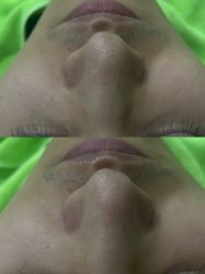 -苗医生0感祛痘连锁