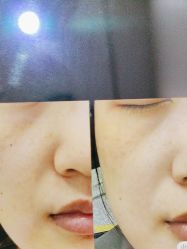 -郡艺医疗美容·微整·眼鼻吸脂