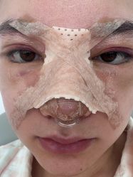 -杭州美莱医疗美容医院