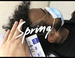 点击看大图 -大麦微针植发全国连锁