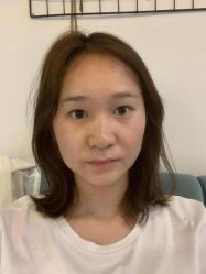 点击看大图 体验前-广东韩妃整形外科医院