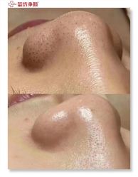 -苗坊净颜痘斑美容护肤连锁