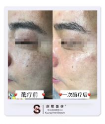 -S庆熙美学皮肤管理
