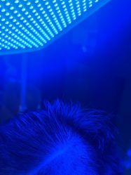 -碧莲盛·不剃发植发