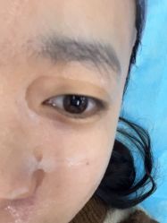 -素美医疗美容·西南眼鼻整形·修复基地