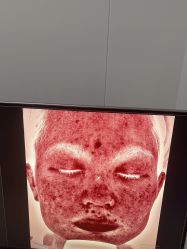 -Yestar杭州艺星医疗美容医院