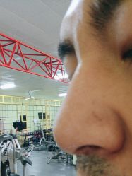 -美安心医美·美迪迈黄金微针·美拉美医疗美容