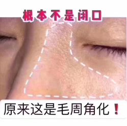 -MLP美丽派·问题肌疗愈中心