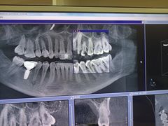 -佛山中大口腔医院·市二级口腔专科医院
